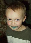 What blue sucker??